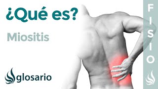 MIOSITIS | Qué es, qué afecta, síntomas, signos clínicos, causas y tratamiento fisioterapéutico