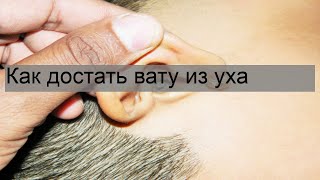 Как достать вату из уха