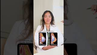 Plastic Surgeon’s favorite procedures for natural breast results. #breastaugmentation #breastimplant