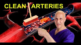 The Best Foods to Clean Arteries & Reverse Plaque (Prevent Heart Attack & Stroke)   Dr. Mandell