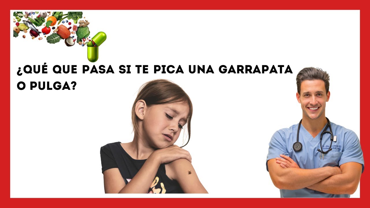 😱¿Qué Pasa Si Te Pica Una Garrapata O Pulga? [Esto Es Lo Que Le OCURRE ...