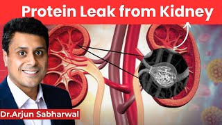 What is Proteinuria?| प्रोटीनुरिया क्या है? Membranous Nephropathy NEW Treatment #CKD #Proteinuria