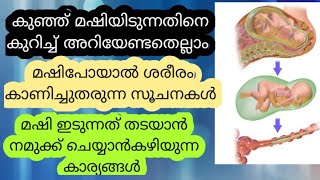 കുഞ്ഞ് വയറിനുള്ളിൽ മഷിയിടുന്നതിനെക്കുറിച് അറിയേണ്ടതെല്ലാം|MECONIUM ASPIRATION SYNDROME| Malayalam