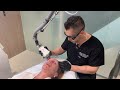 Female Skin Rejuvenation | Fraxel Laser Treatment to the Face | West Hollywood, CA | Dr. Jason Emer