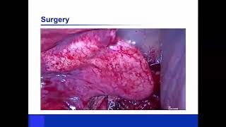 Preoperative Embolization of Bronchopulmonary Sequestration