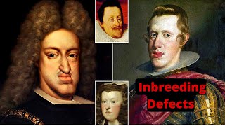 Defects of Inbreeding Royals Suffered through out history