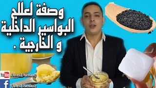 الوصفة#3 : احسن وصفة لعلاج البواسير الداخلية و الخارجية بالسمن حايل و الكفور لبلدي مجربة ومضمونة