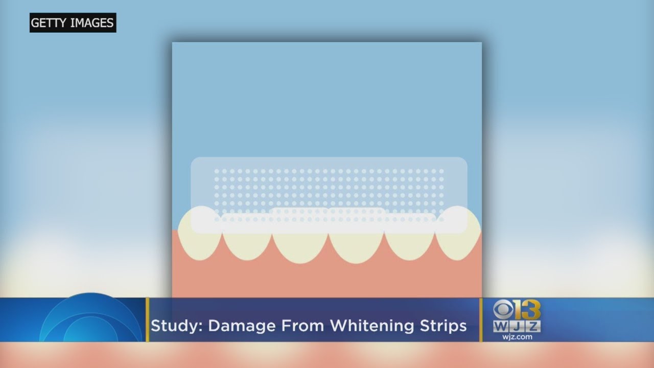 Are Teeth Whitening Strips Harmful At Carole Durante Blog