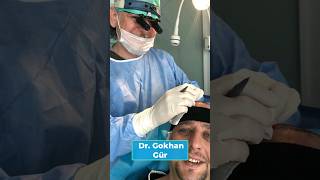 Top Arzt für Haartransplantation in der Türkei | Dr. Gökhan Gür - Vorher Nachher   #derhtexperte