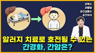 알러지 치료로 호전될 수 있는 간경화, 간암은? (ft. 초기, 말기, 복수, 황달, 간성혼수, 합병증, 간이식)