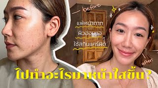 การเดินทางของผิว EP.1: อัพเดทวิธีหน้าใส ใช้จริง เห็นผลจริง! l Dujdow