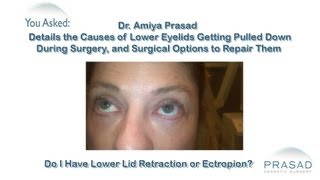 How Sagging Eyelid Skin Caused by Previous Surgery Can be Repaired