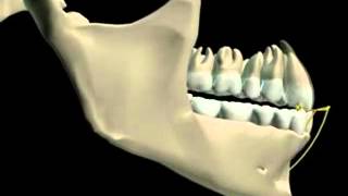 Mandibular Movement 3D