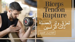تمزق وتر العضلة ذات الرأسين    biceps tendon rupture (subtitled)