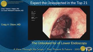 The Unlooked for of Lower Endoscopy