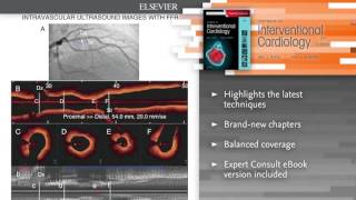 Textbook of Interventional Cardiology, 7th Edition