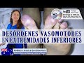 DESÓRDENES VASOMOTORES EN EXTREMIDADES INFERIORES | Jessica Gatchkevitch | Podología Casos y Cosas