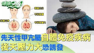 先天性甲亢屬自體免疫疾病 後天壓力大恐誘發 健康2.0 @tvbshealth20