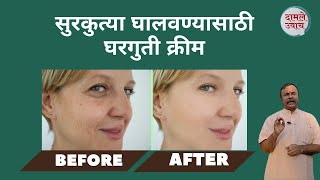 सुरकुत्या घालवण्यासाठी घरगुती क्रीम।How To Get Rid Of Face Wrinkles | Wrinkles Removal | Surkutya