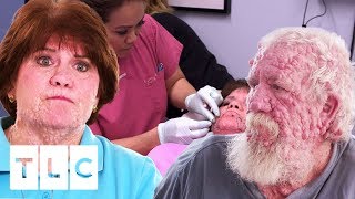 Siblings With Rare Skin Condition Seek Dr. Lee's Help | Dr. Pimple Popper: This Is Zit