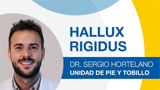 Hallux Rigidus: qué es y tratamiento