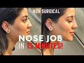 Non-Surgical Rhinoplasty in 15 minutes! I Dr. Barrett Beverly Hills