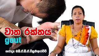 වාත රක්තය   l watha rakthaya |  ayurvedic treatment |   Dr Asoka Wickkramaarachchi