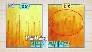 어머…!! 현영의 충격적인 혈류량…?!