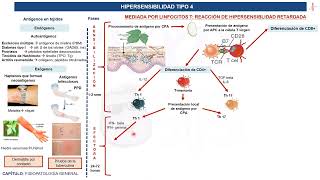 Fisiopatología General- Hipersensibilidad Tipo IV