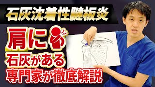 石灰沈着性腱板炎　肩に石灰ができる病気。なりやすい人や治療法について医師が解説します。