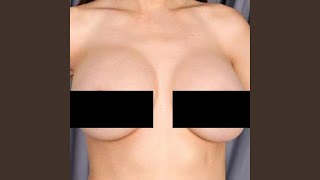 Free The Nipple