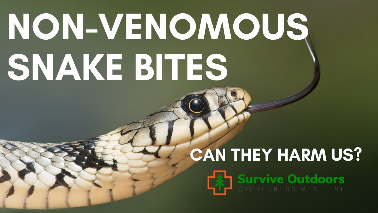 SNAKE BITE Medical Treatment - Non Venomous Snake Bites - YouTube