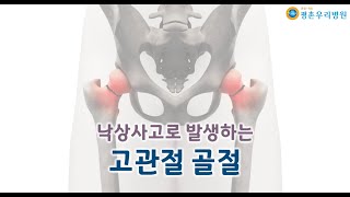 낙상사고로 발생하는 고관절골절