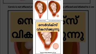 അമ്മ ഒരു കുഞ്ഞിനെ പ്രസവിക്കുന്നത് ഇങ്ങനെയാണ്😥🤱Delivery Stages😱#youtube #subscribe #shorts #video