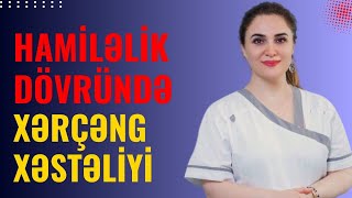 Hamiləlik dövründə XƏRÇƏNG XƏSTƏLİYİ | Onkoloq-Mammoloq İndira Səfərova