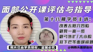 科学矫正【太阳穴凹陷➕高低颧骨➕大小脸➕双下巴】等面部变丑问题《面部案例第18期》