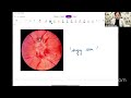 miqseries ophthalmology test u0026 discussion by dr shivani jain fmge jan 25 preparation