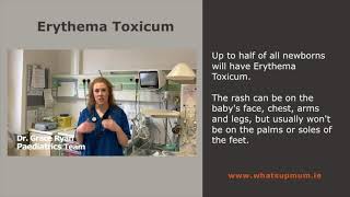 Erythema Toxicum  Full Version F1 DEc 6