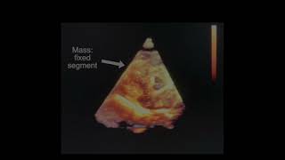 The CVJ April 2022: Video 3 – Echocardiogram: 12-year-old male castrated cocker spaniel