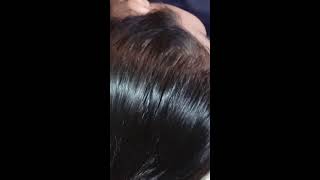 ASMR Scalp \u0026 Head Massage Bliss 💤 Ultimate Tingles for Relaxation \u0026 Sleep (No talking)