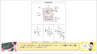 胃切除後の合併症として、 ビルロートⅠ法(Billroth I法)による 輸入脚症候群がある。 （○or×）