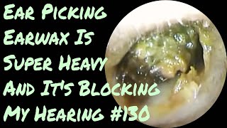 Ear Picking Earwax Is Super Heavy And It's Blocking My Hearing #130