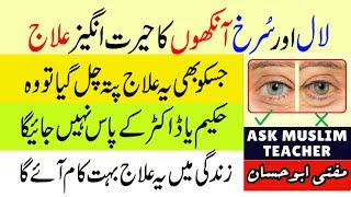 Wazifa for Red Eyes - Laal Ankhon Ka ilaj - Remove Redness from Eyes - Wazifa for Eyes Problems