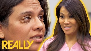 Dr. Lee Removes Cysts From Woman's Eye Lids | Dr. Pimple Popper