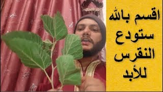 علاج مرض النقرس نهائيا والي الابد بعشبة مباركة _البيورين اليوريك اسد