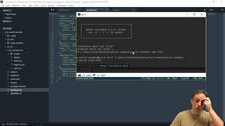 Parcel JS - Part 2: Dev Environment
