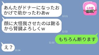 私の顔に大怪我をさせた姉が病気になり、ドナーが必要になった。「あなたの腎臓をちょうだいw」→私が適合者だと知った彼女の反応が面白かったwww