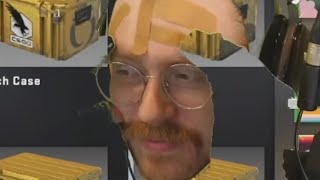out of pocket TTS requests