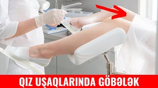 Qız uşaqlarında vaginal göbələk yarandıqda ginekoloji müayinə mütləqdir?