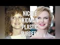 Nicole Kidman Plastic Surgery